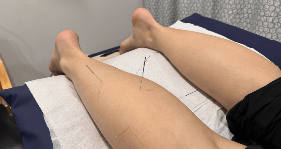 <div element-id="162"><b><br></b></div><div element-id="162"><b>What to Expect with Dry Needling - Initial Assessment and Diagnosis </b></div>